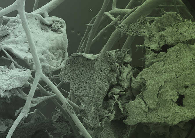 microscopic image of lichen