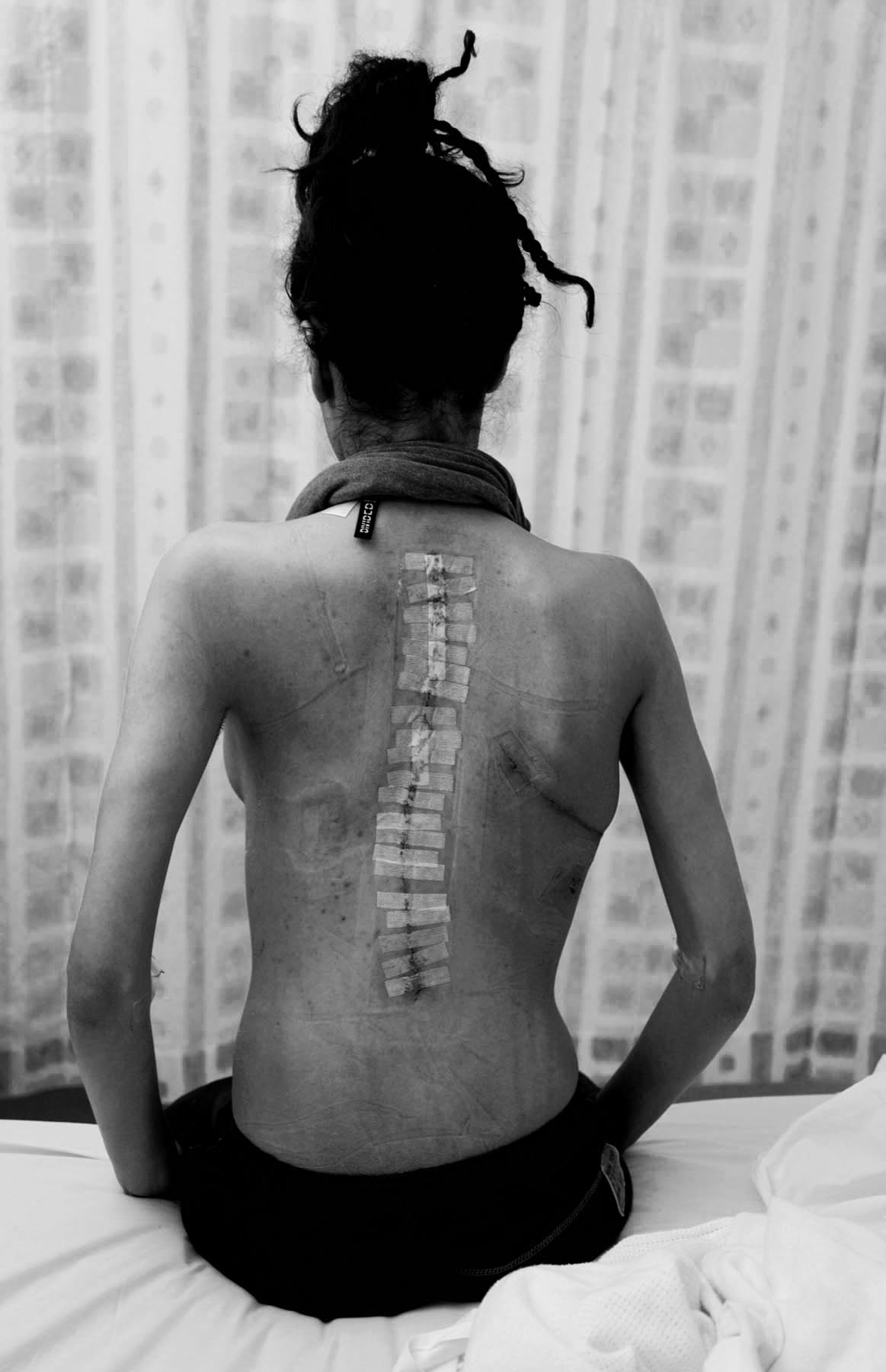 Black-and-white photograph of a person seated upright and viewed from behind. Medical tape runs along their spine, suggesting recovery, endurance, and bodily resilience. 