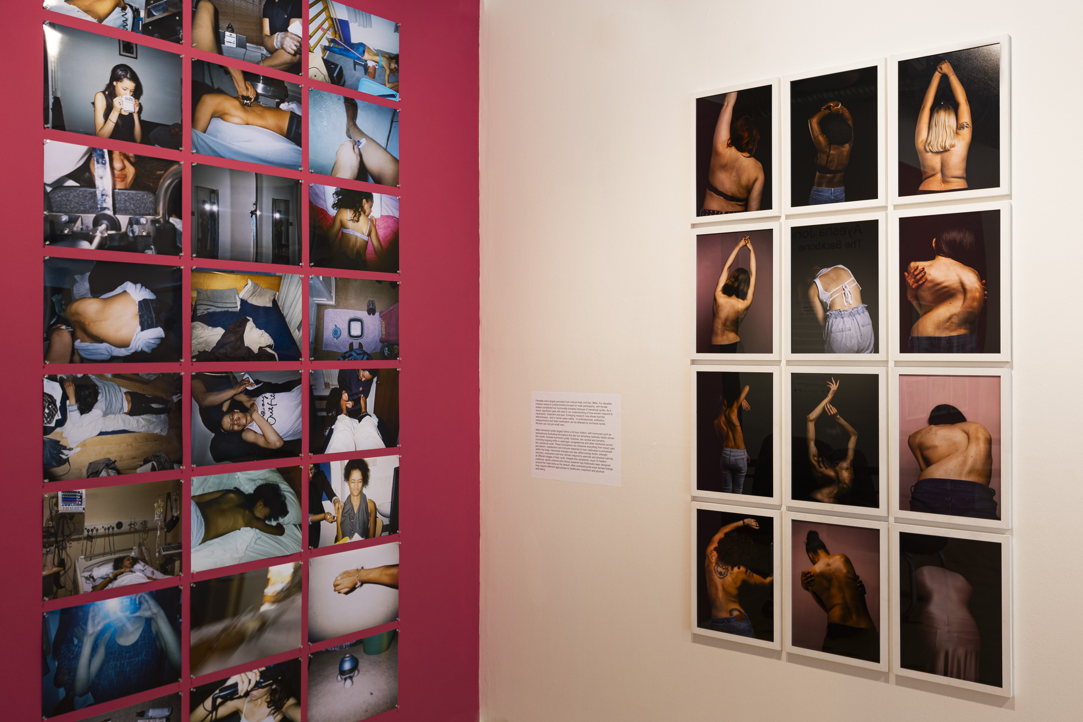 A grid of candid colour photographs on a magenta wall documenting medical experiences and daily life, beside a framed sequence of portraits showing bare backs with surgical scars, part of Ayesha Jones' exhibition.